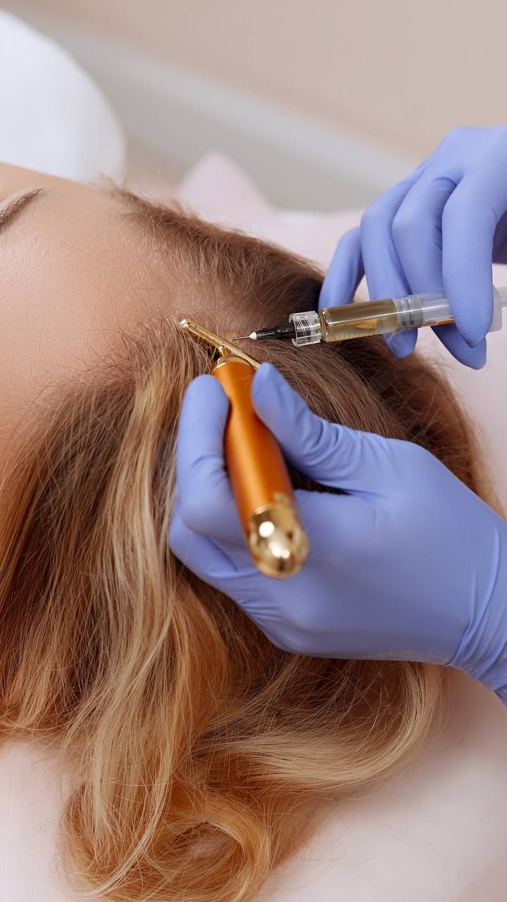 PRP or Exosomes for Hair Restoration