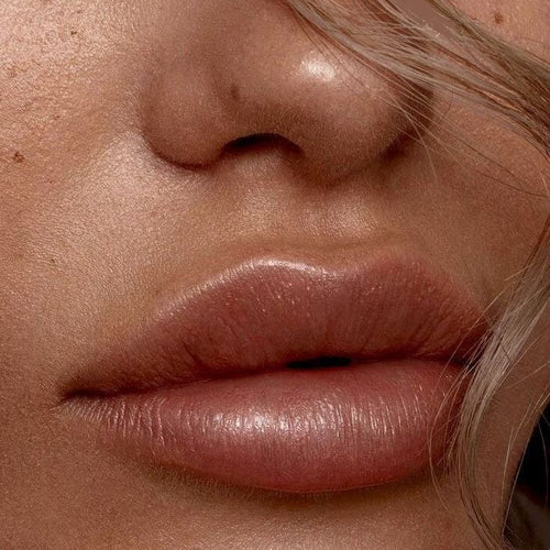 Lip Augmentation