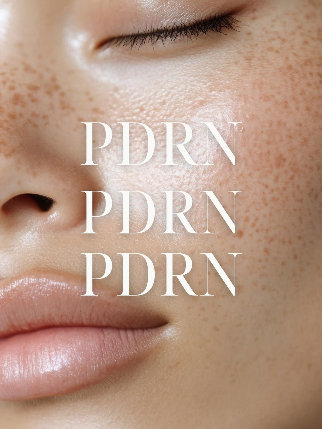 Microneedling with Salmon DNA (PDRN)