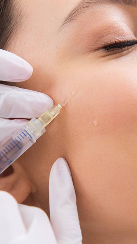 Acne Steroid Injection