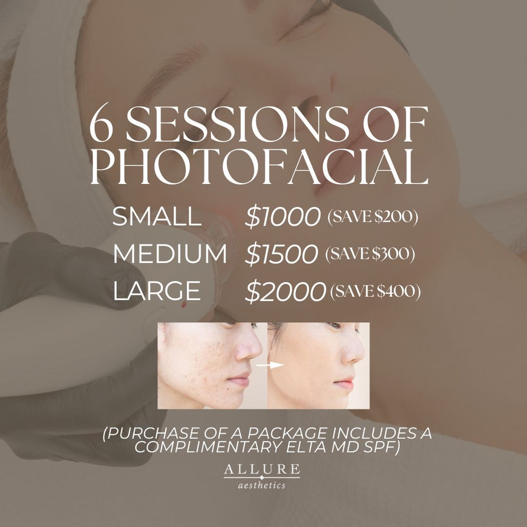 Photofacial Packages