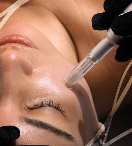 Microneedling - Face