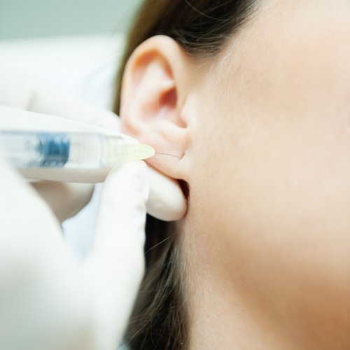Earlobe Filler