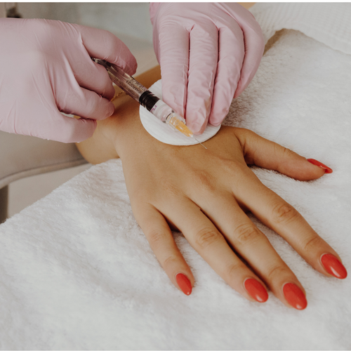 Hand Rejuvenation